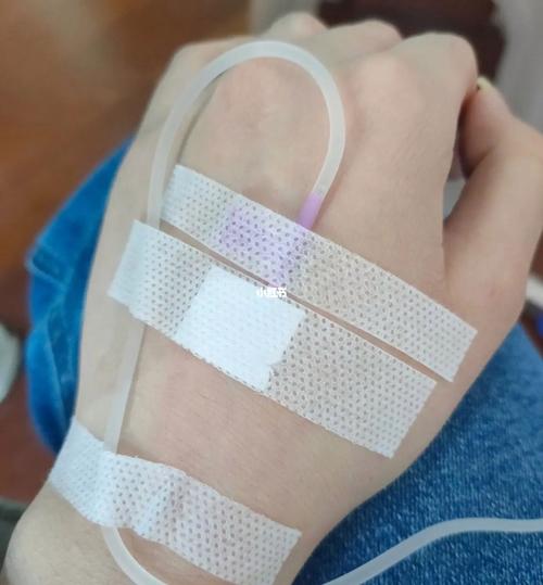 117731.cσm查询澳彩开奖号码和喉咙不适输液后身亡与输液喉咙不舒服