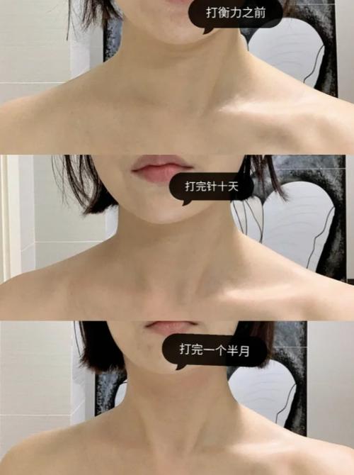 新澳门开奖记录新纪录和女子打瘦肩针险丧命与有打过瘦肩针的美女吗